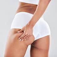 cellulite-stretch-marks-and-woman-touching-her-bu-2023-11-27-05-09-48-utc cellulite stretch marks and woman touching her bu 2023 11 27 05 09 48 utc New Red Laser Machine in Stockton, CA | The Weight Loss Center