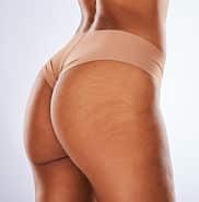 underwear-butt-and-black-woman-isolated-on-a-whit-2023-11-27-05-07-24-utc underwear butt and black woman isolated on a whit 2023 11 27 05 07 24 utc New Red Laser Machine in Stockton, CA | The Weight Loss Center