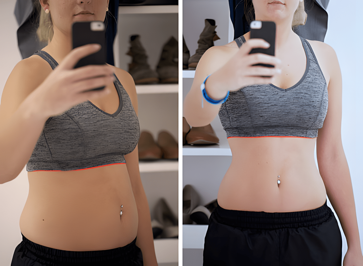 Before and After Image: Weight Loss - front